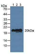 Polyclonal Antibody to Visinin Like Protein 1 (VSNL1)