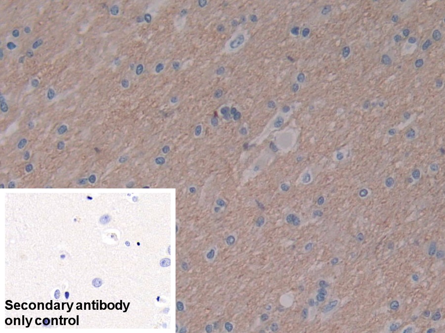 Polyclonal Antibody to Visinin Like Protein 1 (VSNL1)