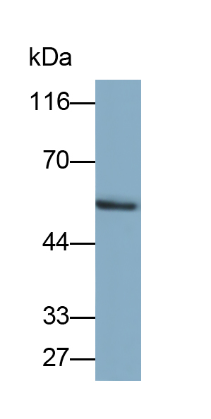Polyclonal Antibody to Mdm2 p53 Binding Protein Homolog (MDM2)