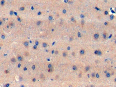 Polyclonal Antibody to Translocation Associated Notch Homolog 1 (TAN1)