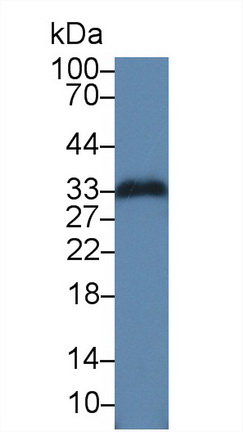 Polyclonal Antibody to Glycine-N-Methyltransferase (GNMT)