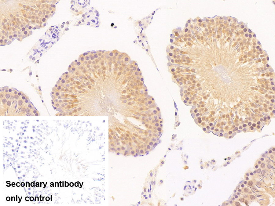 Polyclonal Antibody to Ubiquitin Carboxyl Terminal Hydrolase L3 (UCHL3)