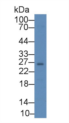 Polyclonal Antibody to Ubiquitin Carboxyl Terminal Hydrolase L1 (UCHL1)