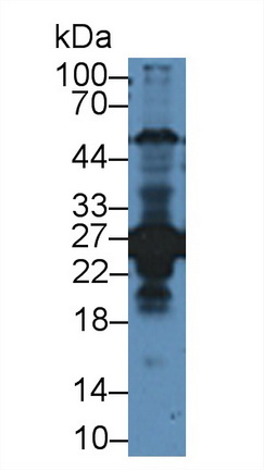 Polyclonal Antibody to Ubiquitin Carboxyl Terminal Hydrolase L1 (UCHL1)