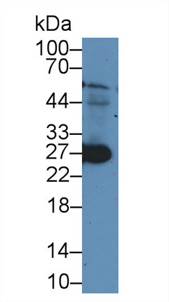 Polyclonal Antibody to Ubiquitin Carboxyl Terminal Hydrolase L1 (UCHL1)