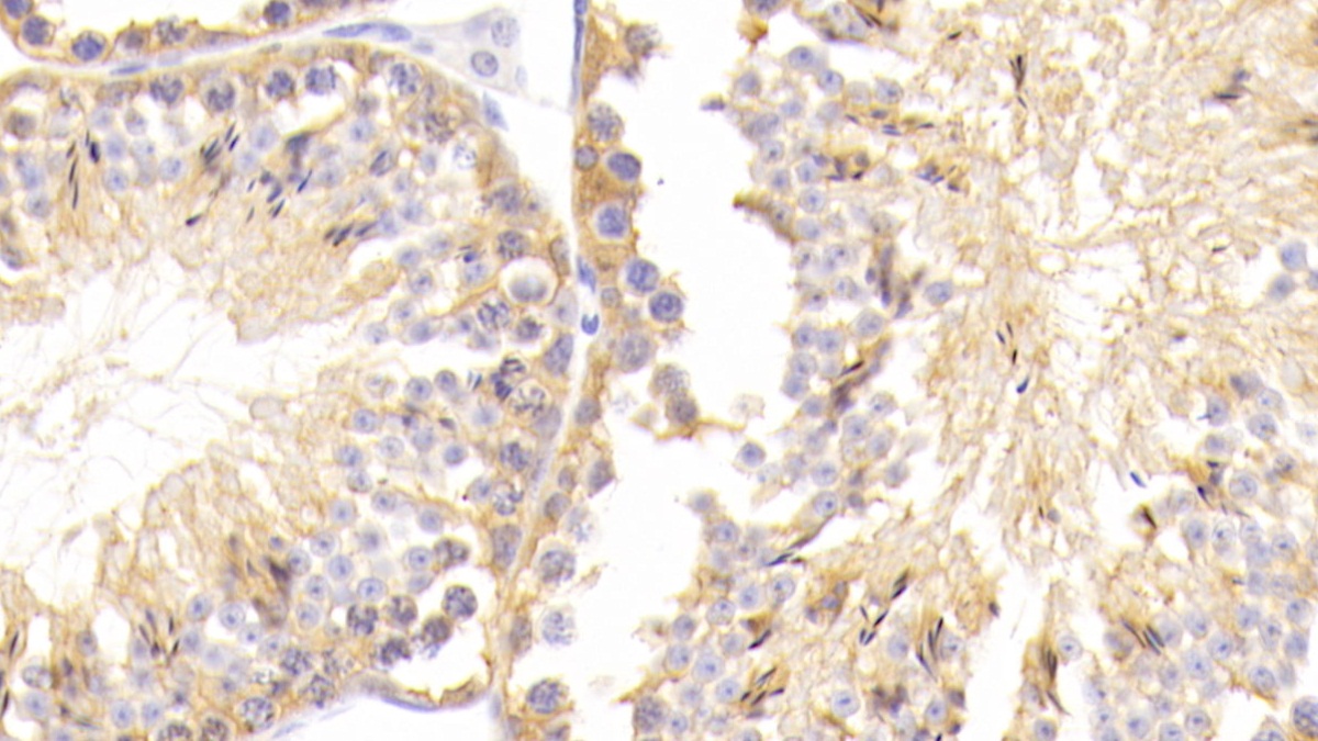 Polyclonal Antibody to Ubiquitin Carboxyl Terminal Hydrolase L1 (UCHL1)