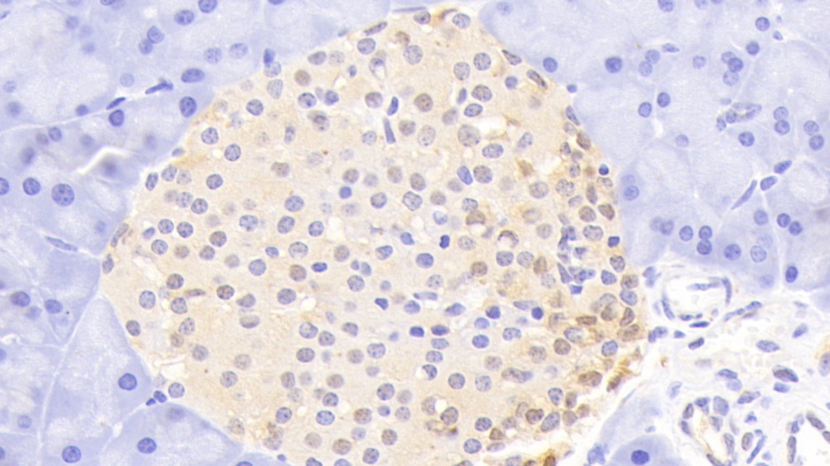 Polyclonal Antibody to Ubiquitin Carboxyl Terminal Hydrolase L1 (UCHL1)