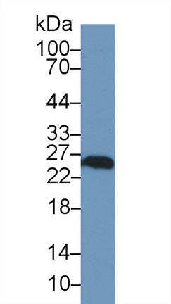 Polyclonal Antibody to Ubiquitin Carboxyl Terminal Hydrolase L1 (UCHL1)