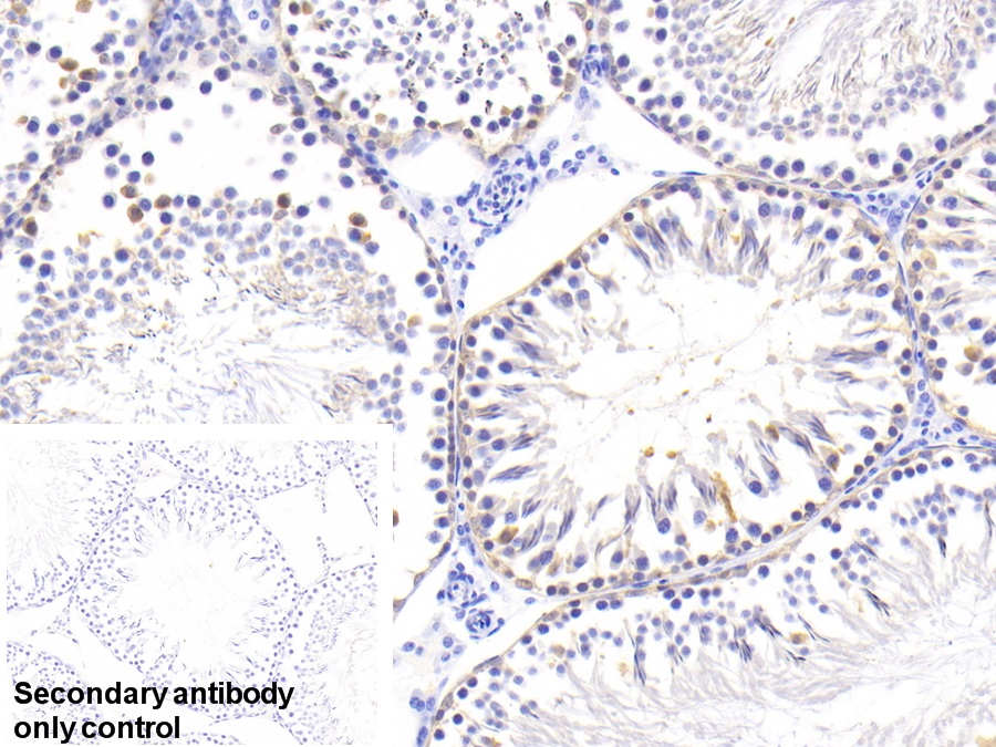 Polyclonal Antibody to Ubiquitin Carboxyl Terminal Hydrolase L1 (UCHL1)