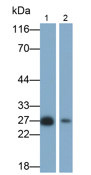 Polyclonal Antibody to Ubiquitin Carboxyl Terminal Hydrolase L1 (UCHL1)