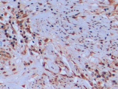 Polyclonal Antibody to Thymidylate Synthetase (TYMS)