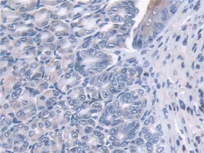 Polyclonal Antibody to Glutaredoxin (GLRX)