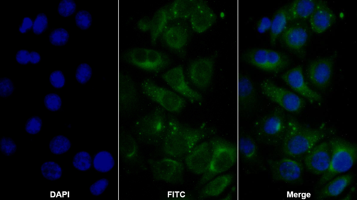 Polyclonal Antibody to TTK Protein Kinase (TTK)