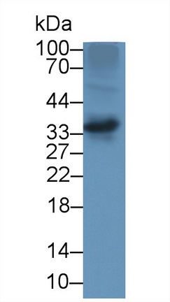 Polyclonal Antibody to Alpha-Tocopherol Transfer Protein (TTPa)