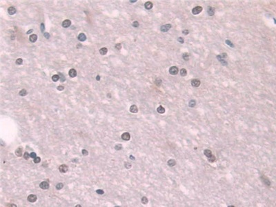 Polyclonal Antibody to Transketolase (TKT)