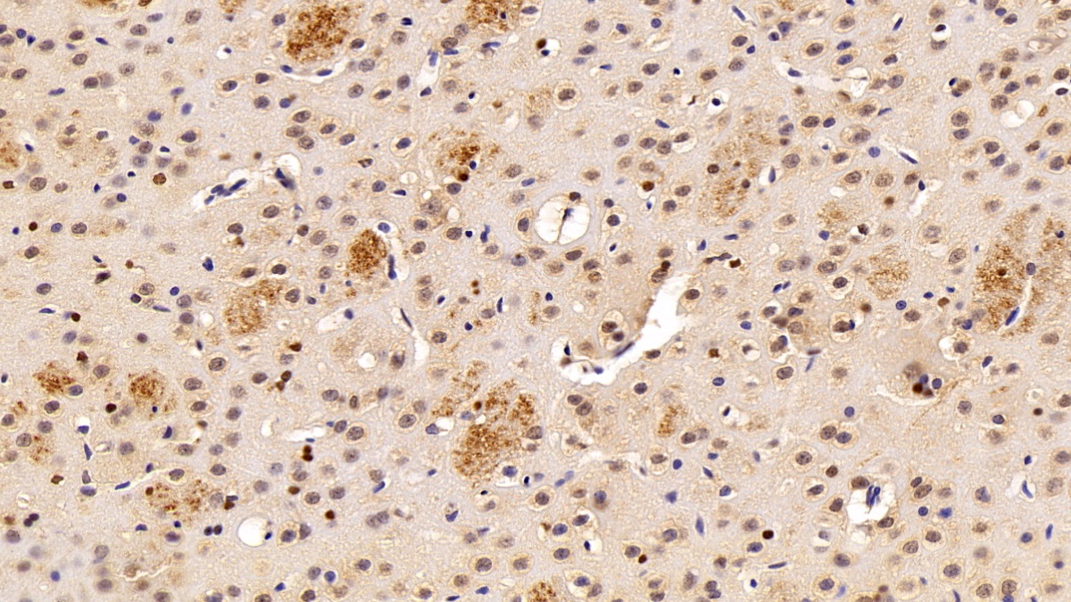 Polyclonal Antibody to Transketolase (TKT)