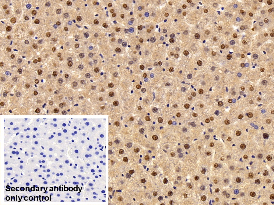 Polyclonal Antibody to Transketolase (TKT)