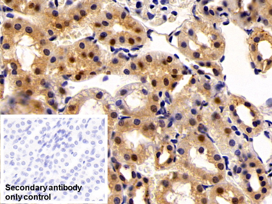 Polyclonal Antibody to Transketolase (TKT)