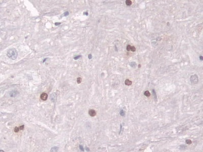 Polyclonal Antibody to Transketolase (TKT)