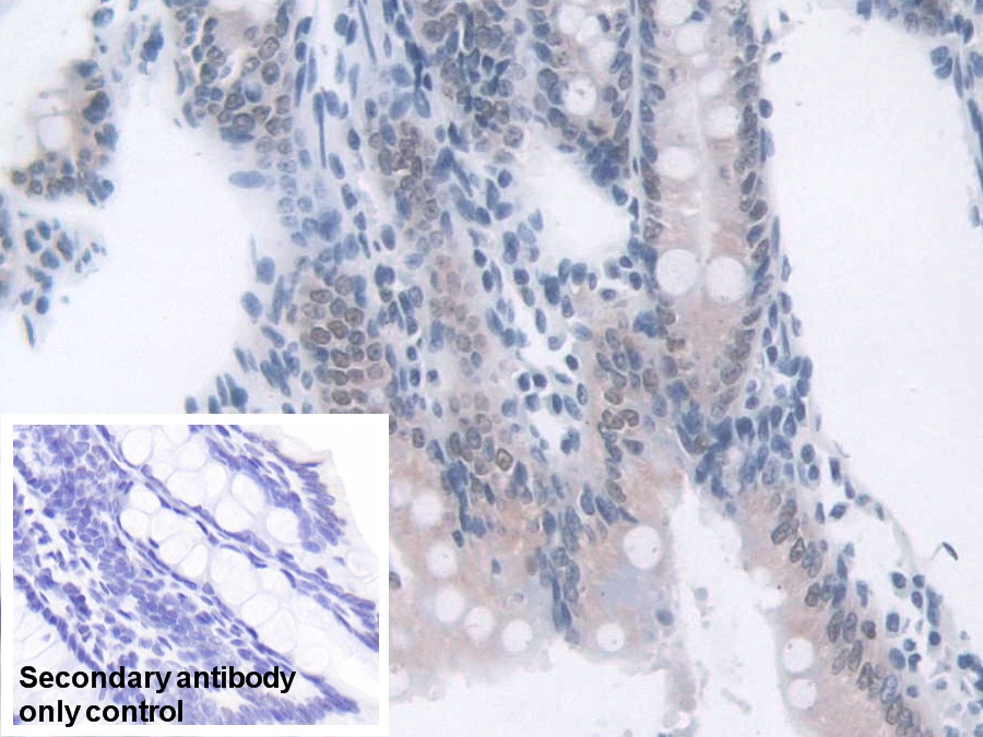 Polyclonal Antibody to Transketolase (TKT)