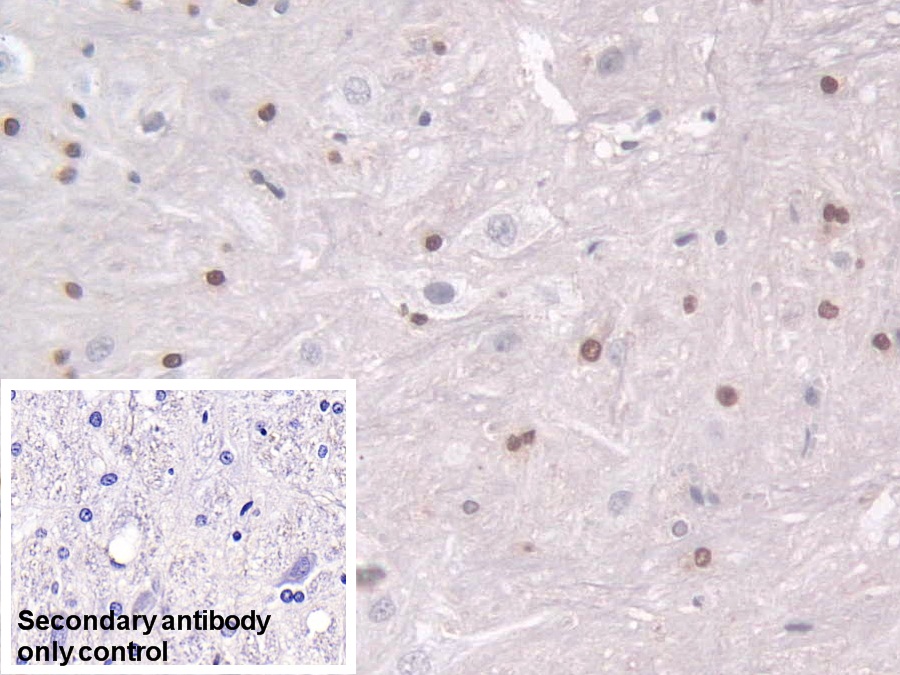 Polyclonal Antibody to Transketolase (TKT)