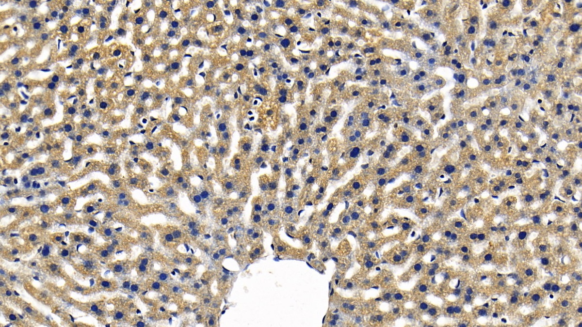 Polyclonal Antibody to TANK Binding Kinase 1 (TBK1)