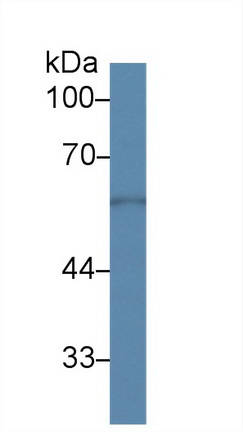 Polyclonal Antibody to Sulfite Oxidase (SUOX)