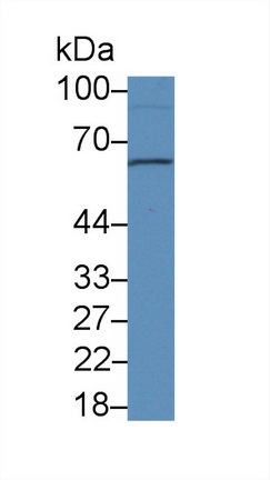 Polyclonal Antibody to Sulfite Oxidase (SUOX)