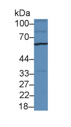 Polyclonal Antibody to Sulfite Oxidase (SUOX)