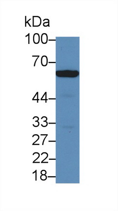 Polyclonal Antibody to Sulfite Oxidase (SUOX)