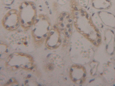 Polyclonal Antibody to Sulfite Oxidase (SUOX)