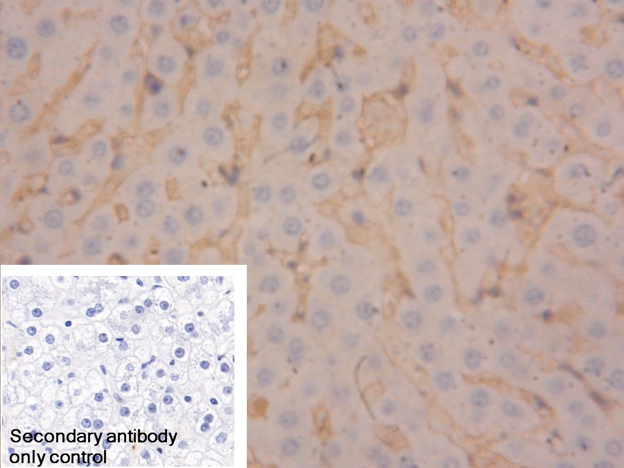 Polyclonal Antibody to Sulfite Oxidase (SUOX)