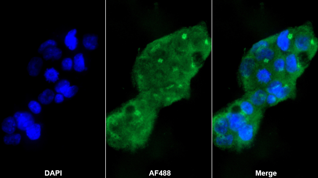 Polyclonal Antibody to Sulfite Oxidase (SUOX)