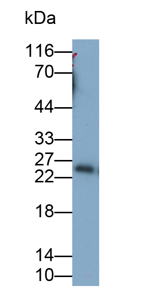 Polyclonal Antibody to Stress Induced Phosphoprotein 1 (STIP1)