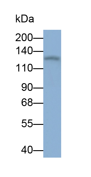 Polyclonal Antibody to Serine Peptidase Inhibitor Kazal Type 5 (SPINK5)