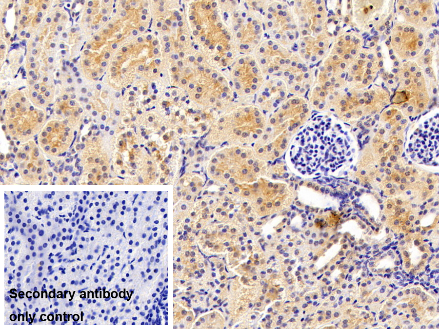 Polyclonal Antibody to SET Binding Protein 1 (SETBP1)
