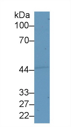 Polyclonal Antibody to Semenogelin I (SEMG1)