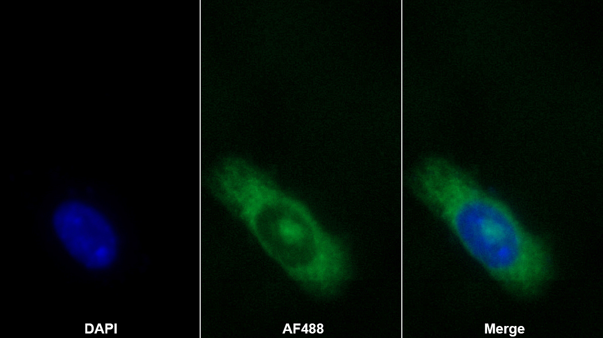 Polyclonal Antibody to Scavenger Receptor Class B Member 1 (SCARB1)