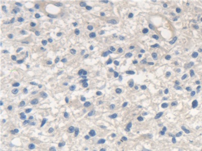 Polyclonal Antibody to Scavenger Receptor Class A Member 5 (SCARA5)