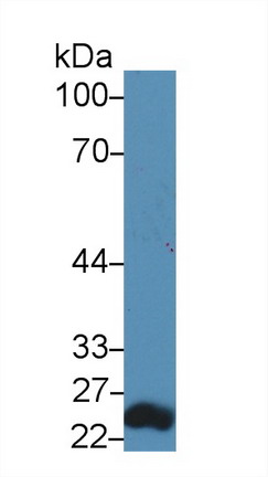 Polyclonal Antibody to Renal Tumor Antigen (RAGE)