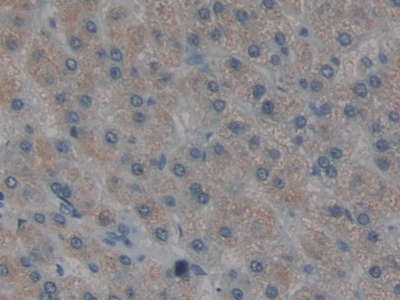 Polyclonal Antibody to Renal Tumor Antigen (RAGE)