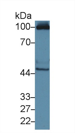 Polyclonal Antibody to Renal Tumor Antigen (RAGE)