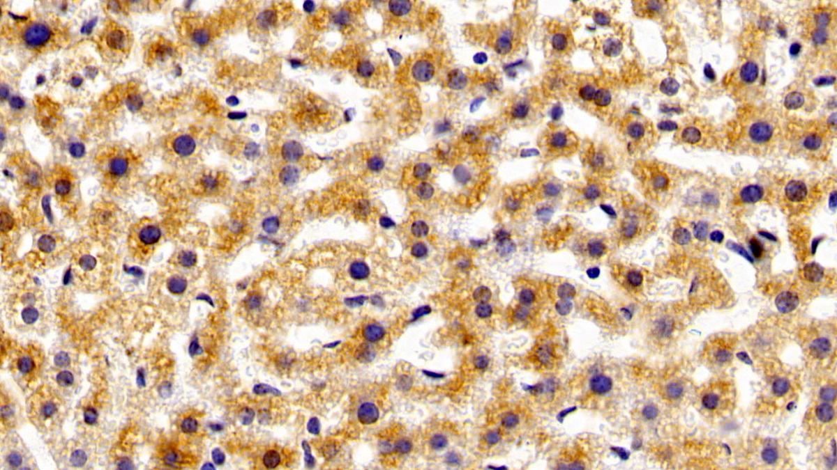 Polyclonal Antibody to Renal Tumor Antigen (RAGE)