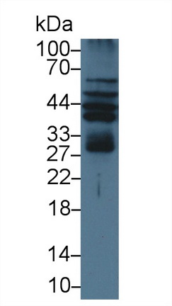 Polyclonal Antibody to Renal Tumor Antigen (RAGE)