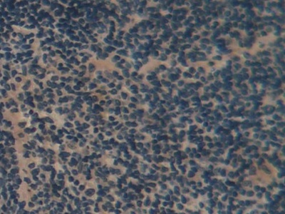 Polyclonal Antibody to Renal Tumor Antigen (RAGE)