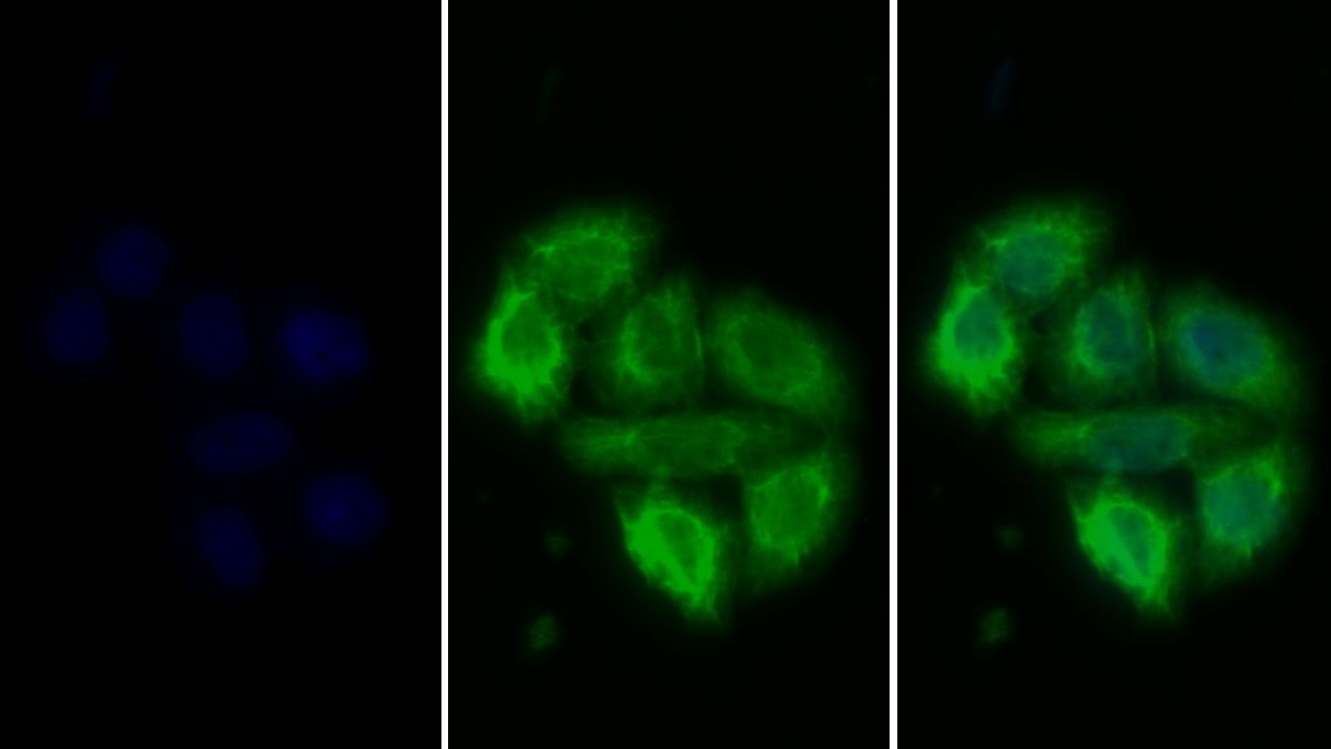 Polyclonal Antibody to Prolactin Receptor (PRLR)