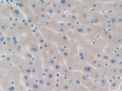 Polyclonal Antibody to Protein Phosphatase, Mg2+/Mn2+ Dependent 1A (PPM1A)