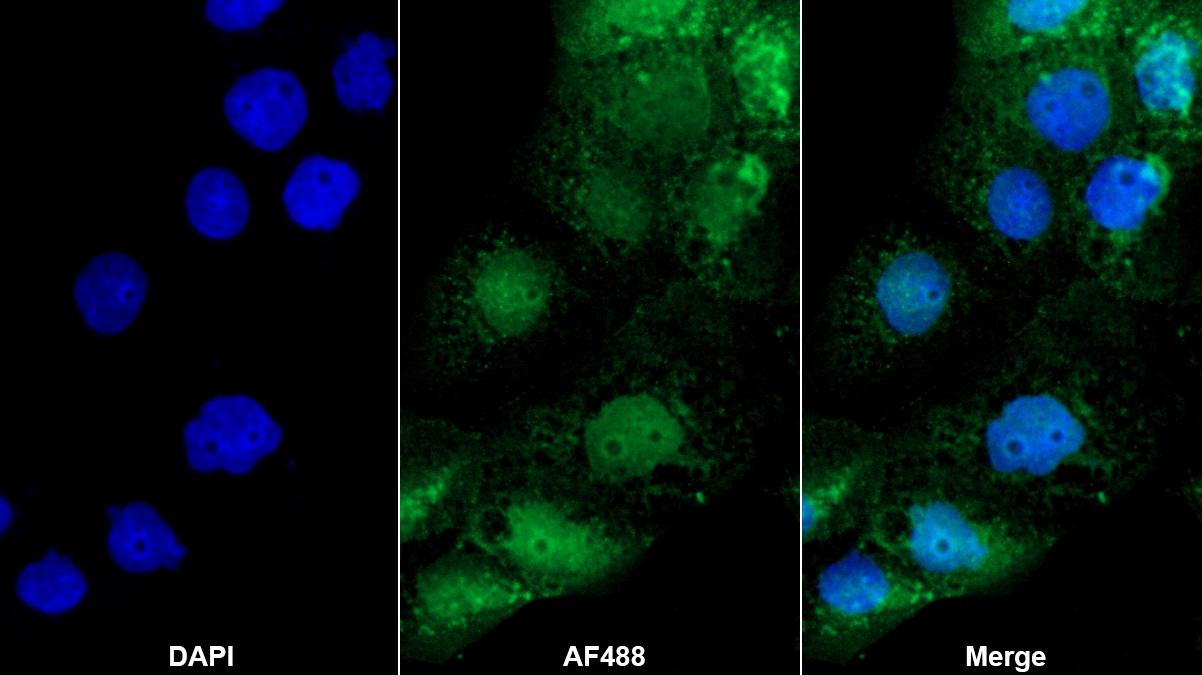 Polyclonal Antibody to Protein Phosphatase, Mg2+/Mn2+ Dependent 1A (PPM1A)