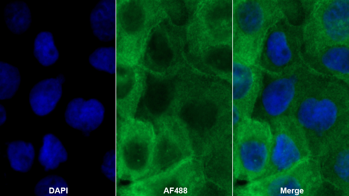 Polyclonal Antibody to Periplakin (PPL)