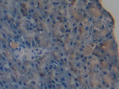 Polyclonal Antibody to Periplakin (PPL)